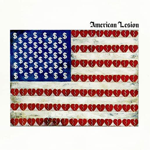 AMERICAN LESION (RED VINYL) (COLV) (RED)