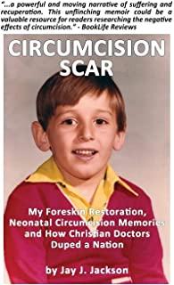 Circumcision Scar: My Foreskin Restoration, Neonatal Circumcision Memories and How Christian Doctors Duped a Nation